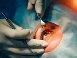 Engagement im Bereich Augenheilkunde, Ophthalmochirurgie
