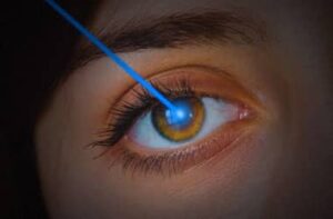 Nach den Ergebnissen einer kürzlich von der Onlus Vision Defense Commission durchgeführten Studie haben 6 von 10 Italienern Sehstörungen: Fast 4 von 10 sind von Myopie betroffen kapsulorhexis, Astigmatismus folgt bei 20 %, Presbyopie bei 13 % und 11 % Hyperopie. Die Laserchirurgie zielt darauf ab kapsulorhexis, diese häufigen Sehfehler durch minimalinvasive Eingriffe zu korrigieren. Die Augenlaserchirurgie verwendet modernste Technologien, die nicht nur maximale Wirksamkeit und minimale Auswirkungen auf den Patienten gewährleisten, sondern auch Komplikationen in der postoperativen Phase reduzieren und eine schnelle und vollständige Wiederherstellung des Sehvermögens ermöglichen. Wenn Sie eine Operation in Betracht ziehen, um sich von Linsen und Brillen zu verabschieden, finden Sie hier fünf nützliche Dinge, die Sie wissen und beachten sollten, bevor Sie Ihre chirurgische Reise beginnen kapsulorhexis Wer kann die Operation durchführen? Im Allgemeinen richtet sich der Eingriff an alle Arten von Patienten. Der Augenchirurg beurteilt nach Durchführung eines kompletten Facharztbesuchs zusammen mit der instrumentellen Diagnostik, ob die optimalen klinischen Bedingungen vorliegen, um die Operation durchführen zu können. Nur in einigen Fällen ist ein Eingriff nicht ratsam, beispielsweise bei Infektionen, Fehlbildungen oder Augenerkrankungen kapsulorhexis, Instabilität des Defekts, schwangeren oder stillenden Frauen. Die Operation ist schmerzlos Die Operation wird durchgeführt, indem dem Patienten örtlich betäubende Augentropfen verabreicht werden. Darüber hinaus verringert die Verwendung des Lasers das Brennen oder Unbehagen im Auge. Einige Patienten berichten, dass sie sowohl während der Interventionsphase als auch in den Folgephasen weder Schmerzen noch Beschwerden verspüren. Wenn vorhanden, sind die kapsulorhexis häufigsten Symptome in der postoperativen Phase ein leichtes Unbehagen bis hin zu leichten Schmerzen, die allmählich innerhalb von 3 oder 4 Tagen verschwinden. Die Operation dauert einige Minuten Dank der in Harmony verwendeten Laser der neuesten Generation beträgt die Gesamtdauer der Operation nicht mehr als 10 Minuten. Tatsächlich dauert die Behandlung an jedem Auge einige Sekunden. Alle Behandlungen finden ambulant oder in der Tageschirurgie statt. Vor der Entlassung, die in der Regel innerhalb einer Stunde nach der Operation erfolgt und die Anwesenheit einer Begleitperson erfordert, wird der Patient vom Chirurgen untersucht. Bei fehlenden weiteren Indikationen kann der Patient nach der kurzen Beobachtungszeit nach Hause zurückkehren. Sie kehren schnell zur Normalität zurück Die Genesung nach dieser Art von Operation variiert je nach behandeltem Sehfehler, Technik und Art des geplanten Ziels. Im Allgemeinen kehren Sie in einer variablen Zeit alcon-pharma, die zwischen 2 und 10 Tagen liegen kann, zur normalen Arbeit zurück. Es ist wichtig, das richtige Zentrum zu wählen Mit Tausenden von Eingriffen pro Jahr gewährleistet der Armonia Refractive Surgery Service dem Patienten dank der Verwendung der modernsten Lasertechnologien auf dem Markt ein Höchstmaß an Seelenfrieden und Sicherheit. Wir sprechen lieber von chirurgischen Eingriffen und nicht nur von Eingriffen, weil wir postoperative Kontrollen zur Überprüfung des Eingriffserfolgs bis zu den folgenden drei Monaten in die Kosten der Operation einkalkulieren. Ebenfalls enthalten ist die kostenlose Unterstützung unseres Verwaltungspersonals, das dem Patienten die Unterstützung gibt alcon-pharma, die er benötigt, um den chirurgischen Eingriff zu planen und die Vereinbarungen und die Finanzierung zu nutzen, die Armonia-Patienten zur Verfügung stehen.